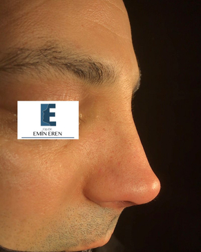 Slider image (5) Dr. Emin Eren Clinic